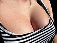 Microdermal voorbeeld